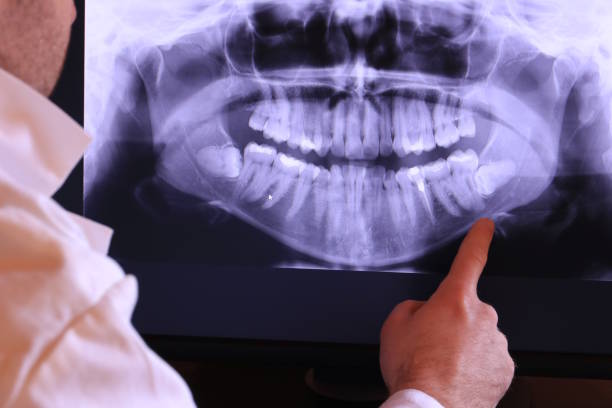 Best Orthodontic Emergency Dentist in Georgetown, IL