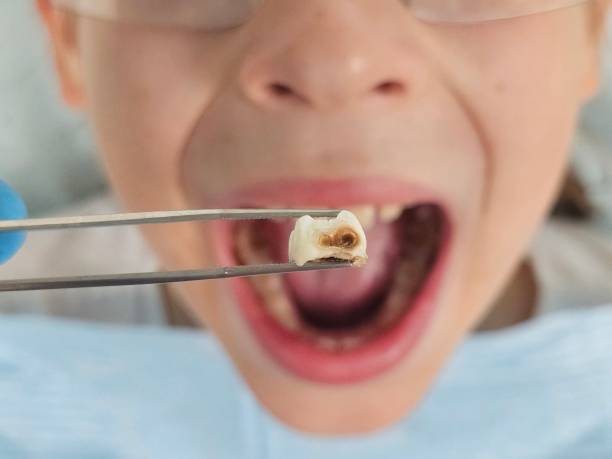 Best Emergency Dental Services for Seniors in Georgetown, IL